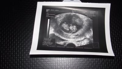 Bild zu ultraschallbild - Baby Forum - Allgemeine Themen