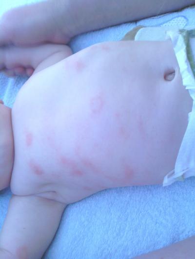 Bild zu Ich weiß, ihr seid keine Kinderärzte... - Baby Forum - Allgemeine Themen