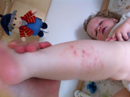 Bild zu