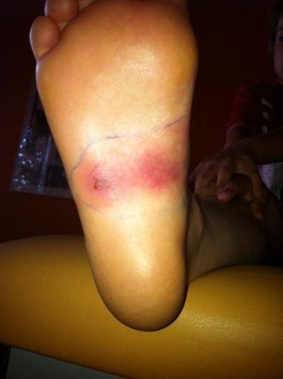 Bild zu So, wir sind zurück vom Kinderarzt.......Achtung mit Foto! - Baby Forum - Allgemeine Themen