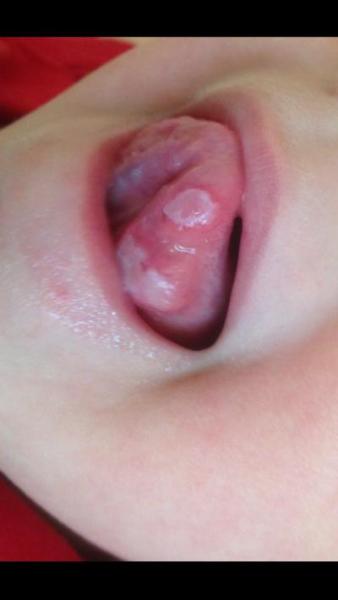 Bild zu Scheisse Hilfe - Baby Forum - Allgemeine Themen