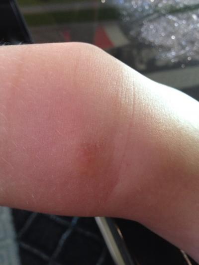 Bild zu Brauch nen schnellen Rat - Baby Forum - Allgemeine Themen