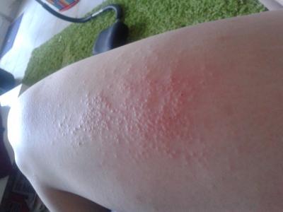 Bild zu jemand eine Ahnung was das ist?? - Baby Forum - Allgemeine Themen