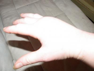 Bild zu Tip bei Wespenstich gesucht - Baby Forum - Allgemeine Themen