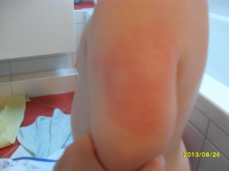 Bild zu 