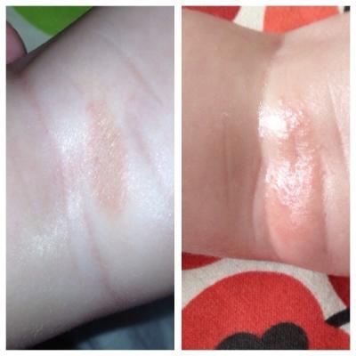 Bild zu Haut"ausschlag"? - Baby Forum - Allgemeine Themen