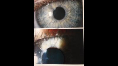 Bild zu 6h in der Augenklinik verbracht.... - Baby Forum - Allgemeine Themen