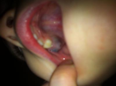Bild zu Dringend!!! Kind 3 seltsame Entdeckung im Mund Foto - Baby Forum - Allgemeine Themen