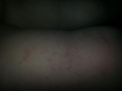 Bild zu Ausschlag - Baby Forum - Allgemeine Themen