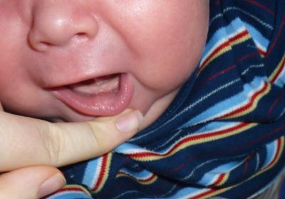 Bild zu ist das ein Zahn?? - Baby Forum - Allgemeine Themen
