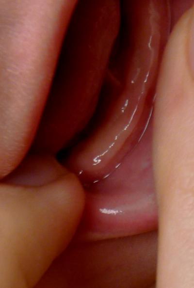 Bild zu der erste Zahn :) geschafft :) - Baby Forum - Allgemeine Themen