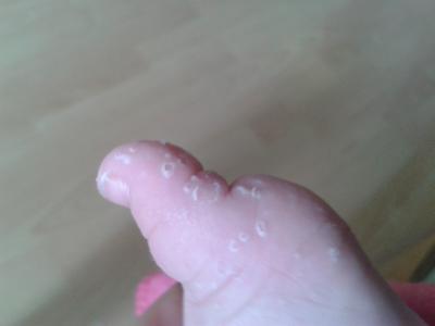 Bild zu was ist das? - Baby Forum - Allgemeine Themen