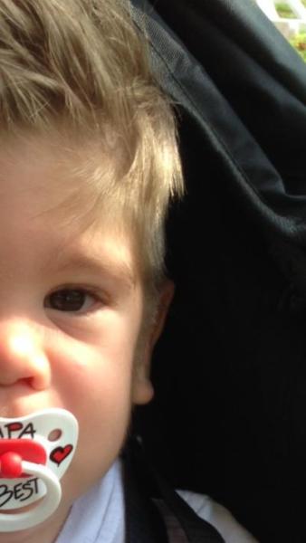Bild zu Falte? - Baby Forum - Allgemeine Themen