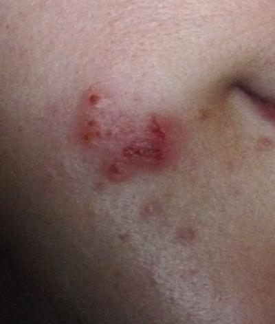 Bild zu Was ist das? - Baby Forum - Allgemeine Themen
