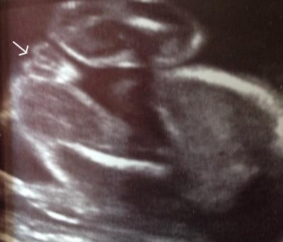 Bild zu Wirklich ein Mädchen? - Baby Forum - Allgemeine Themen