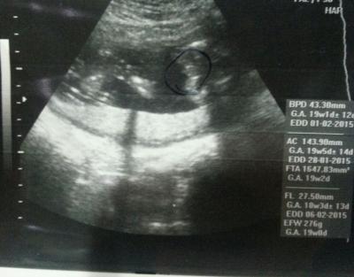 Bild zu Outing Junge oder Mädchen - Baby Forum - Allgemeine Themen
