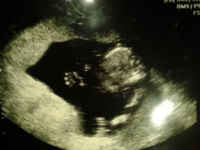Bild zu rutinen Untersuchung - Baby Forum - Allgemeine Themen