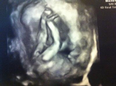 Bild zu Das sind mal lange Beine, oder? - Baby Forum - Allgemeine Themen