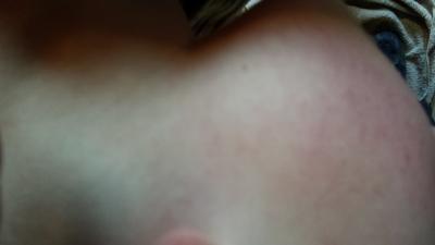 Bild zu Auschlag nur an den Wangen - Baby Forum - Allgemeine Themen