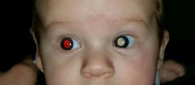 Bild zu "seltsame Augen" bei Blitzlicht - Baby Forum - Allgemeine Themen