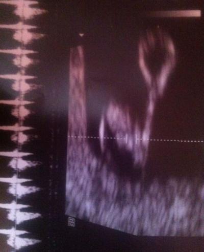 Bild zu Angeber Posting - Baby Forum - Allgemeine Themen