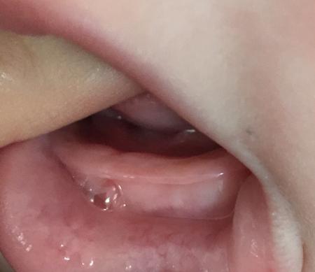 Bild zu Hier nochmal ein Bild.Seht ihr was? - Baby Forum - Allgemeine Themen