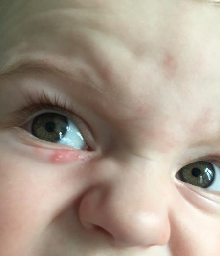 Bild zu Was könnte das sein??? - Baby Forum - Allgemeine Themen