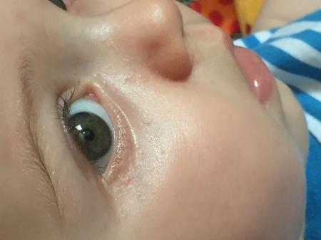 Bild zu Was könnte das denn nur sein?! :-( - Baby Forum - Allgemeine Themen