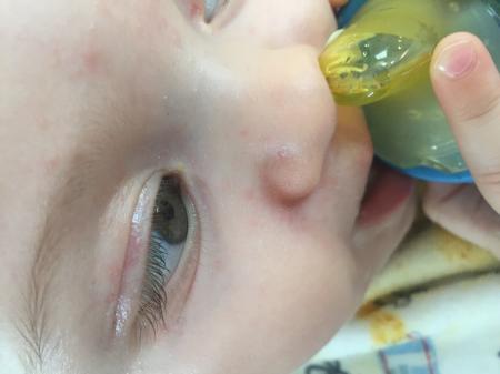 Bild zu 