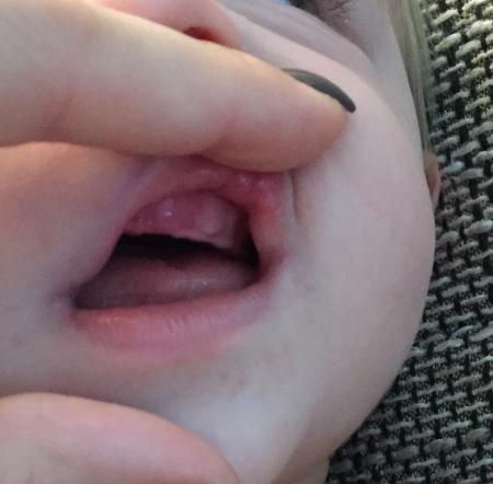 Bild zu Kurze Frage mit Bild... - Baby Forum - Allgemeine Themen