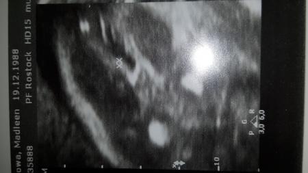 Bild zu Junge oder Mädchen??? - Baby Forum - Allgemeine Themen