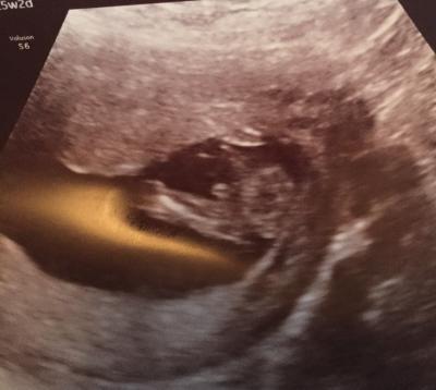 Bild zu Outing 15+2 - Baby Forum - Allgemeine Themen
