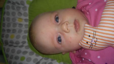 Bild zu Allergie bei baby? - Baby Forum - Allgemeine Themen