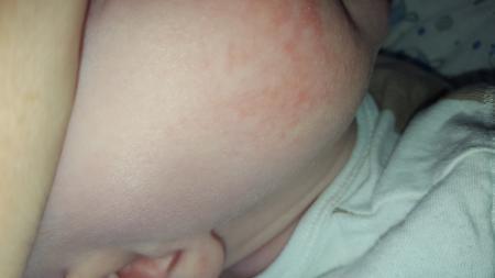Bild zu Hilfe!kennt das jemand??? - Baby Forum - Allgemeine Themen