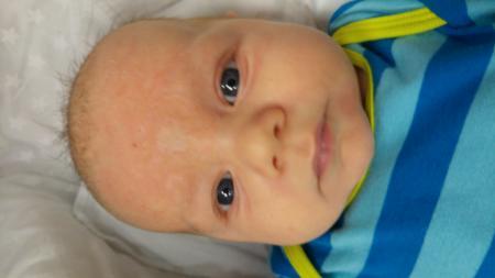 Bild zu