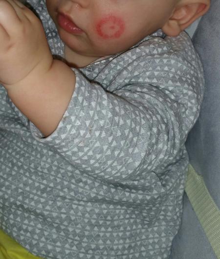 Bild zu