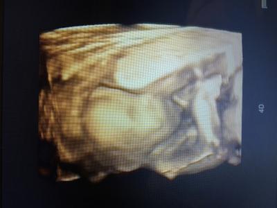 Bild zu Ausnahmsweise ... - Baby Forum - Allgemeine Themen