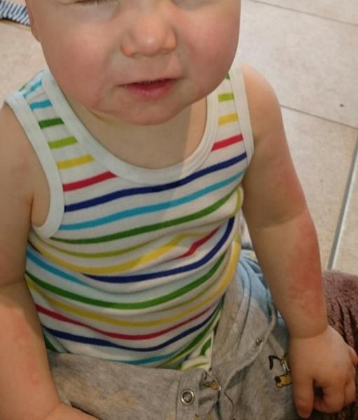 Bild zu Hilfe, nochmal Haut vom Kind - Baby Forum - Allgemeine Themen