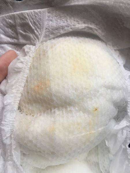 Bild zu Flecken in Windel *Achtung Bild* - Baby Forum - Allgemeine Themen