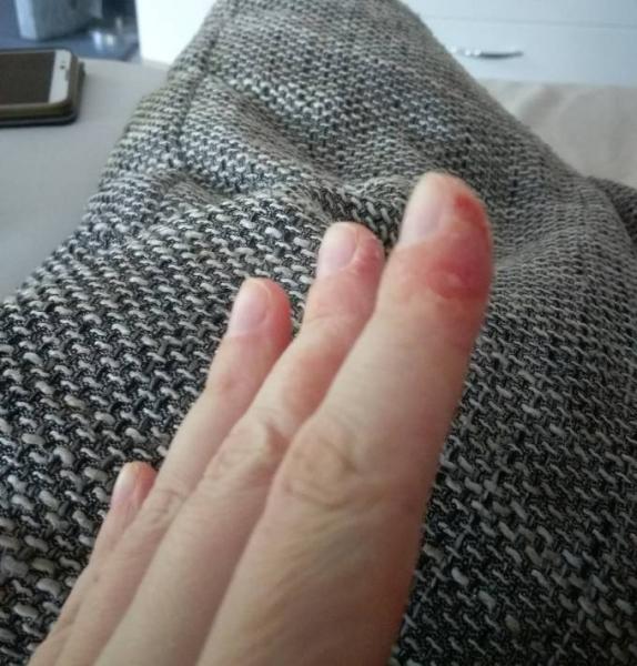 Bild zu Handcreme - Baby Forum - Allgemeine Themen