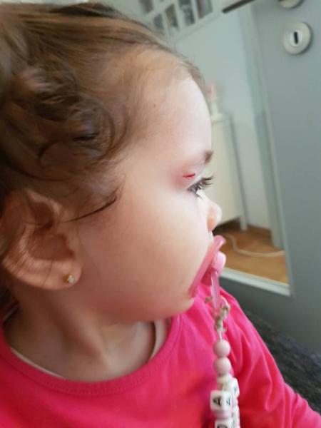 Bild zu Muss ich damit zum arzt bitte mal helfen !!! - Baby Forum - Allgemeine Themen
