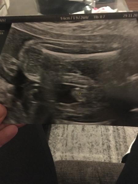 Bild zu Geschlecht Baby - Baby Forum - Allgemeine Themen