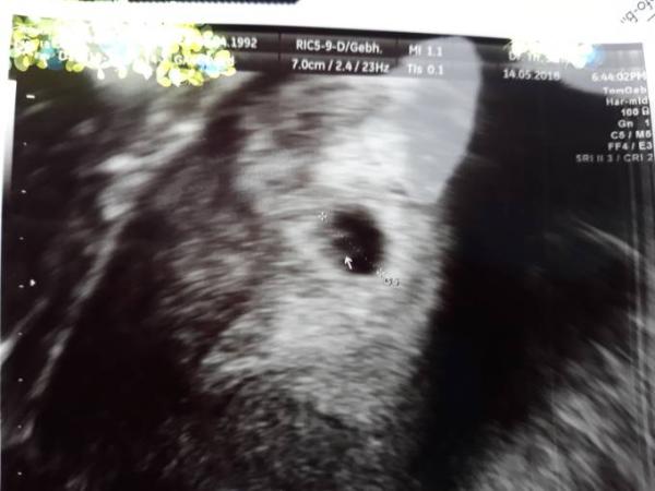 Bild zu Zurück vom frauenarzt - Baby Forum - Allgemeine Themen