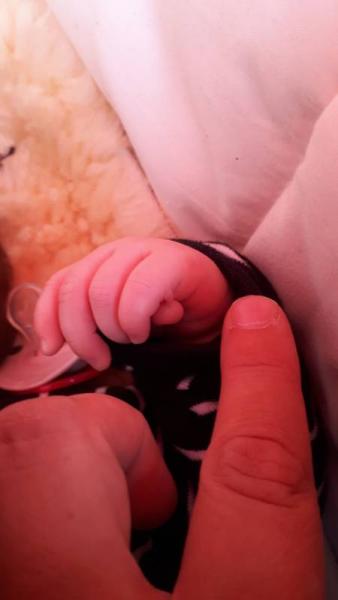 Bild zu Anhängsel entfernen lassen - Baby Forum - Allgemeine Themen