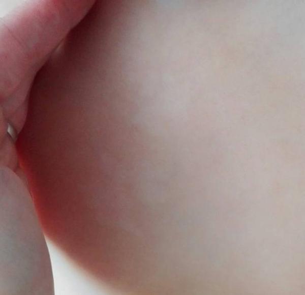 Bild zu Weisse Flecken auf Oberkörper - Baby Forum - Allgemeine Themen