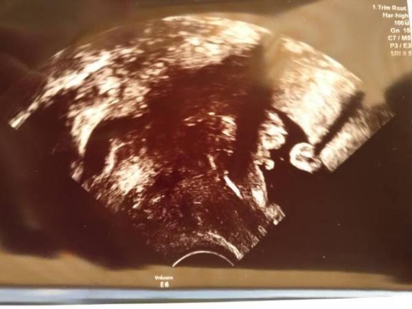 Bild zu Geschlecht Baby - Baby Forum - Allgemeine Themen