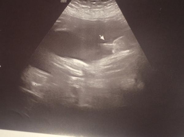 Bild zu Junge oder ?? - Baby Forum - Allgemeine Themen