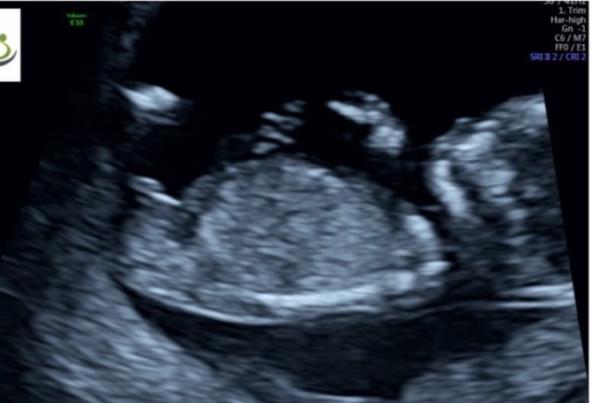 Bild zu Was ist es denn nun? :) - Baby Forum - Allgemeine Themen