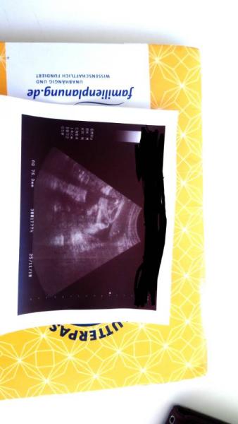 Bild zu Erkennt ihr das Geschlecht??? - Baby Forum - Allgemeine Themen