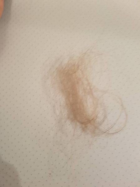 Bild zu Hilfe brauche Rat!!! - Baby Forum - Allgemeine Themen